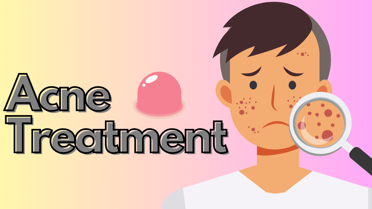 Acne Treatment