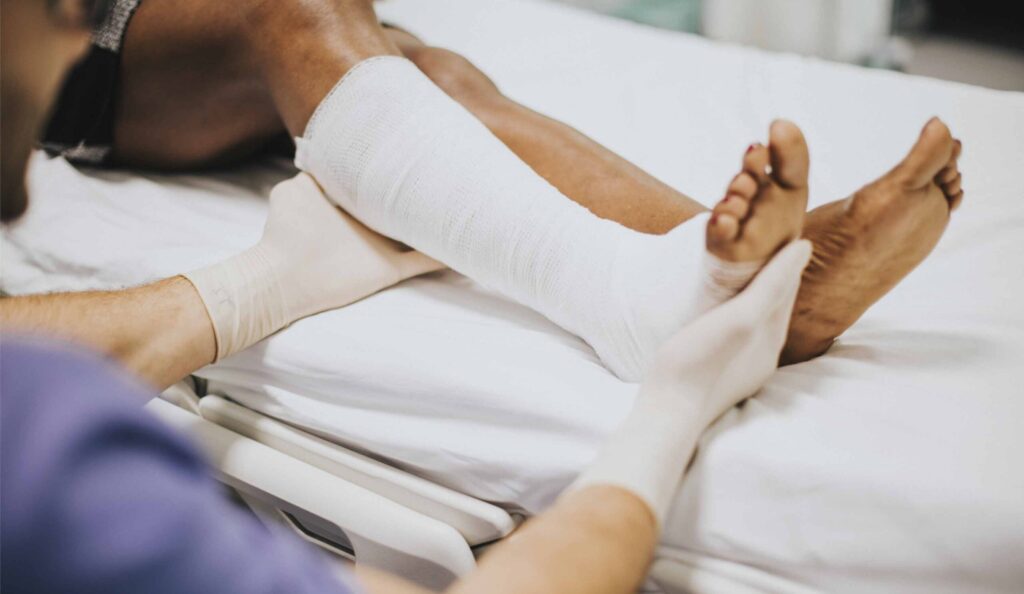 Complications of Non-Union Fractures